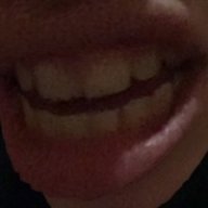 nfer1ght